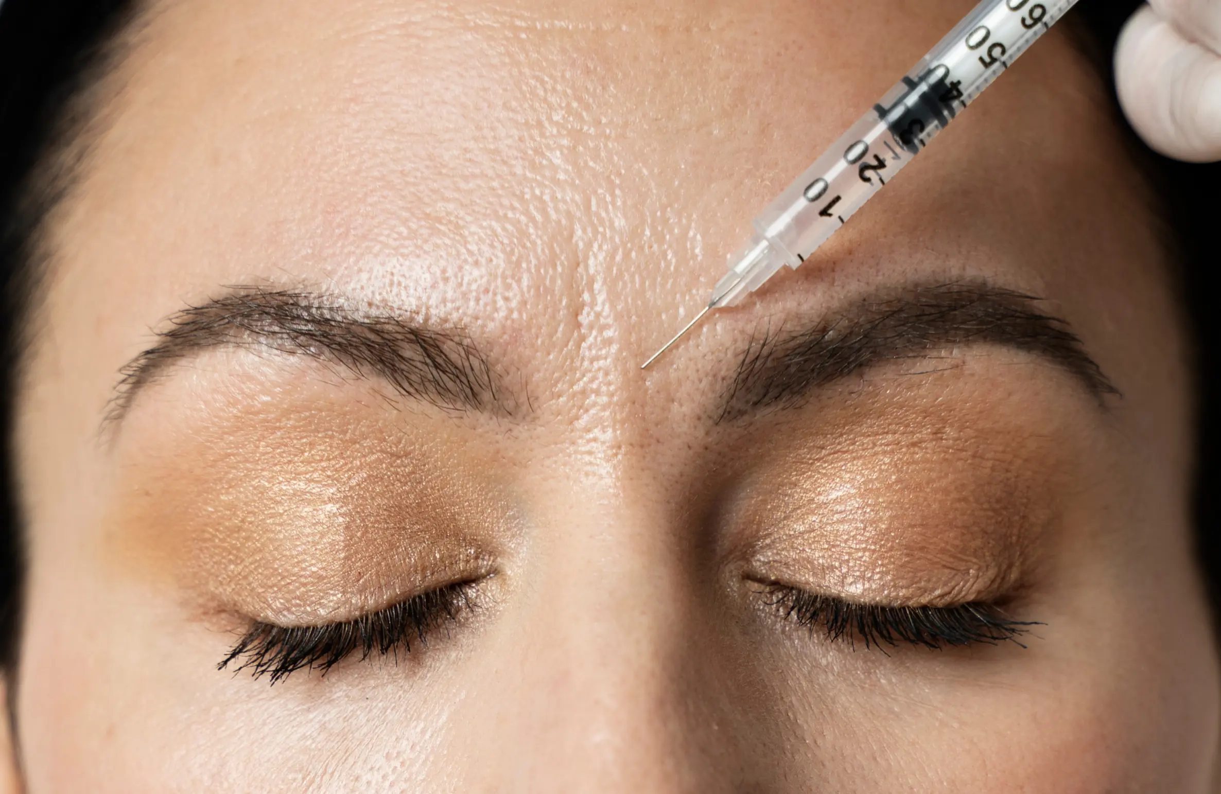 A woman receiving an anti-ageing injection on her forehead to reduce wrinkles and fine lines. This minimally invasive treatment helps achieve smoother, youthful-looking skin, commonly used in Botox procedures.
