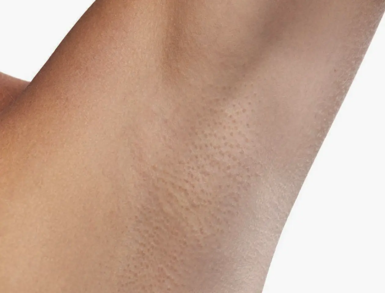 Mask group (82) Mask group (82)