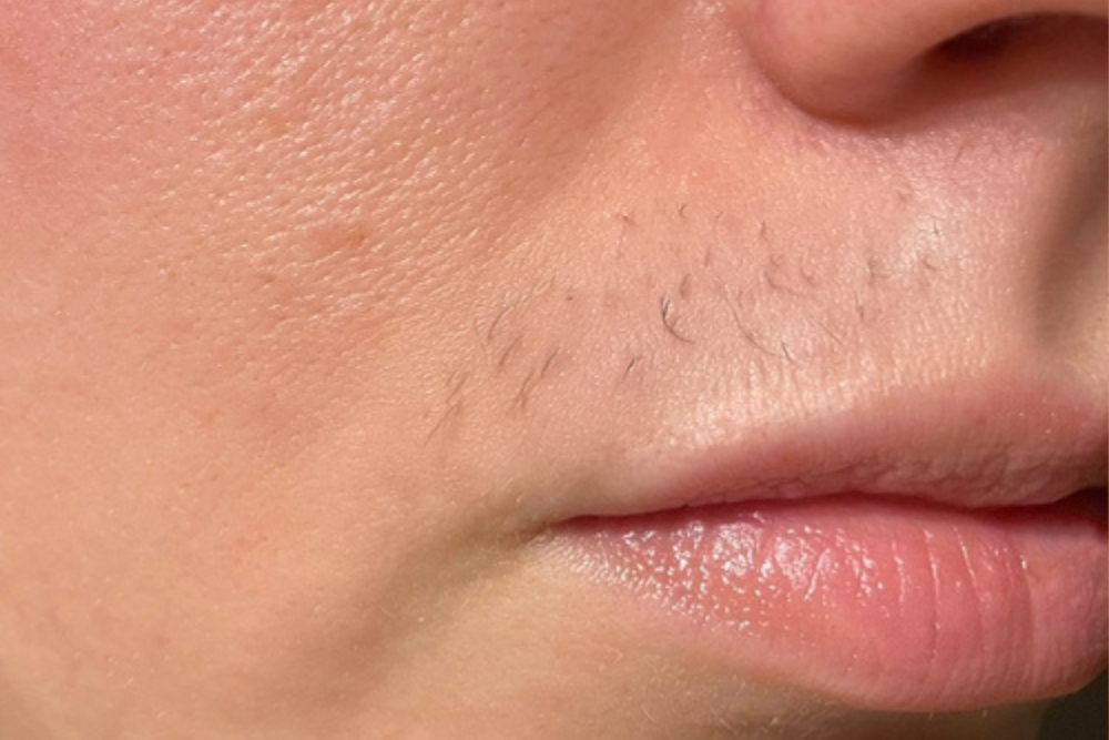 Untitled design (17) Untitled design (17)