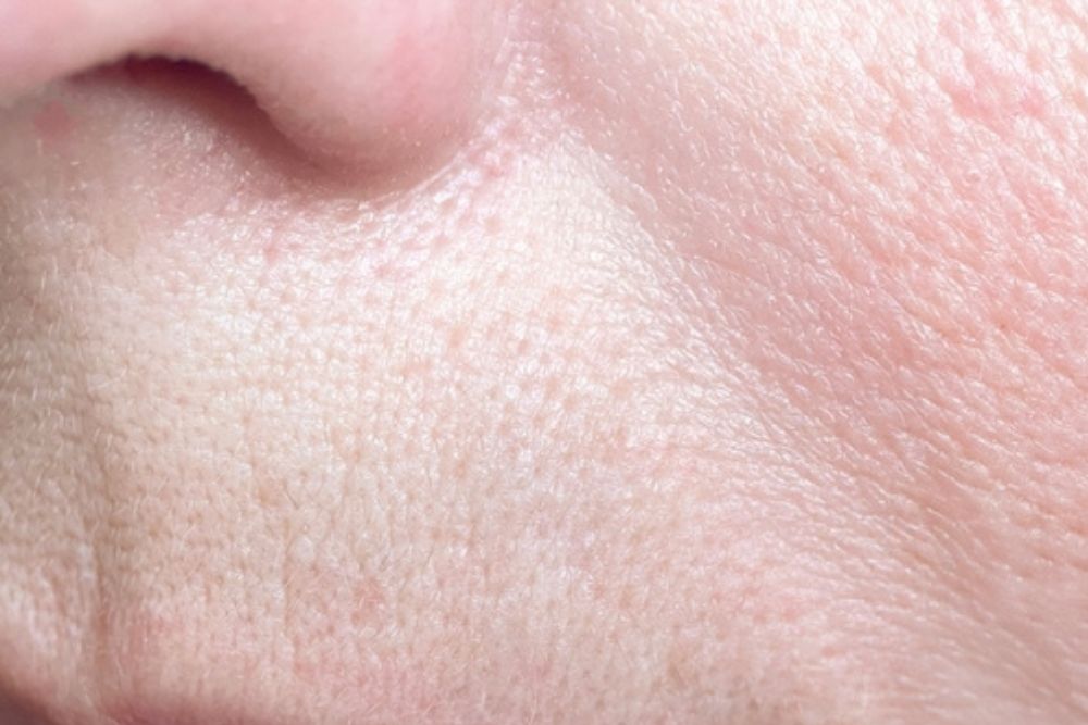 Anti-Aging-Treatment-After-Zennara