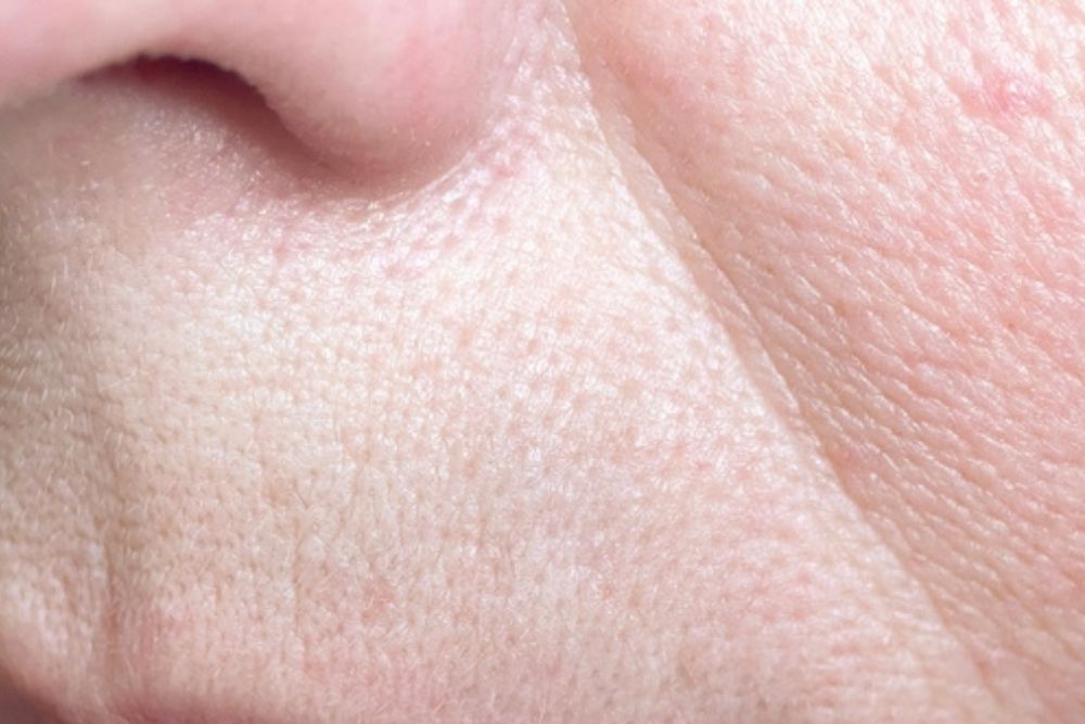 Anti-Aging-Treatment-Before-Zennara