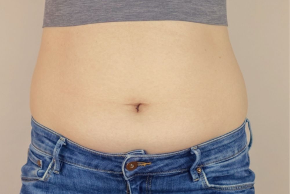 Fat-Reduction-Before-Zennara