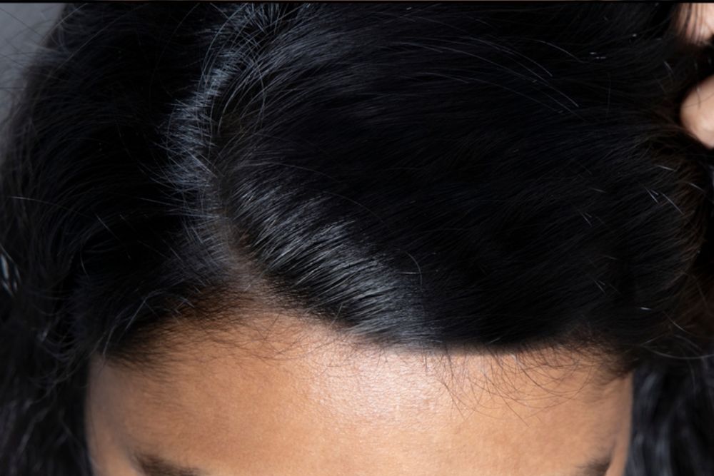 Hair-Treatment-After-Zennara