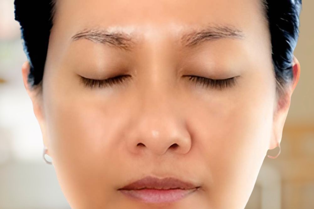 Pigmentation-After-Zennara