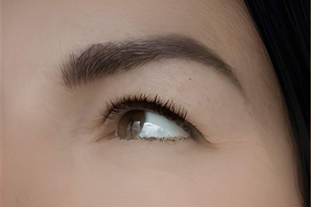 Skin-Rejuvenation-After-Zennara