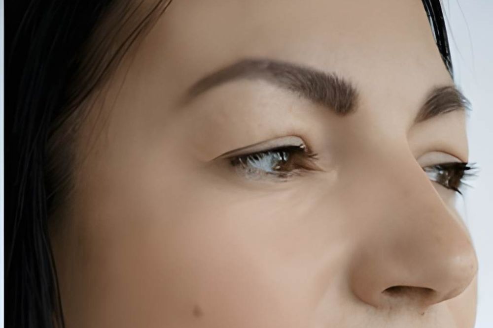 Skin-whitening-After-Zennara