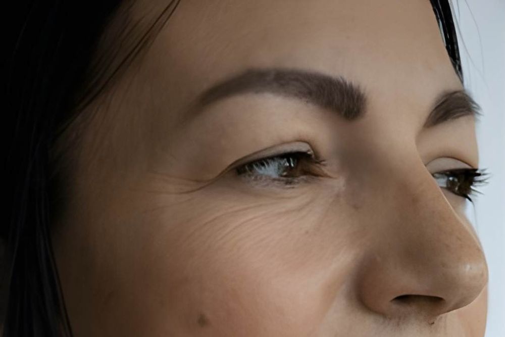 Skin-whitening-Before-Zennara