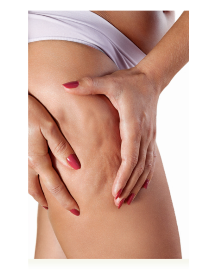 cellulite_treatment_Zennara